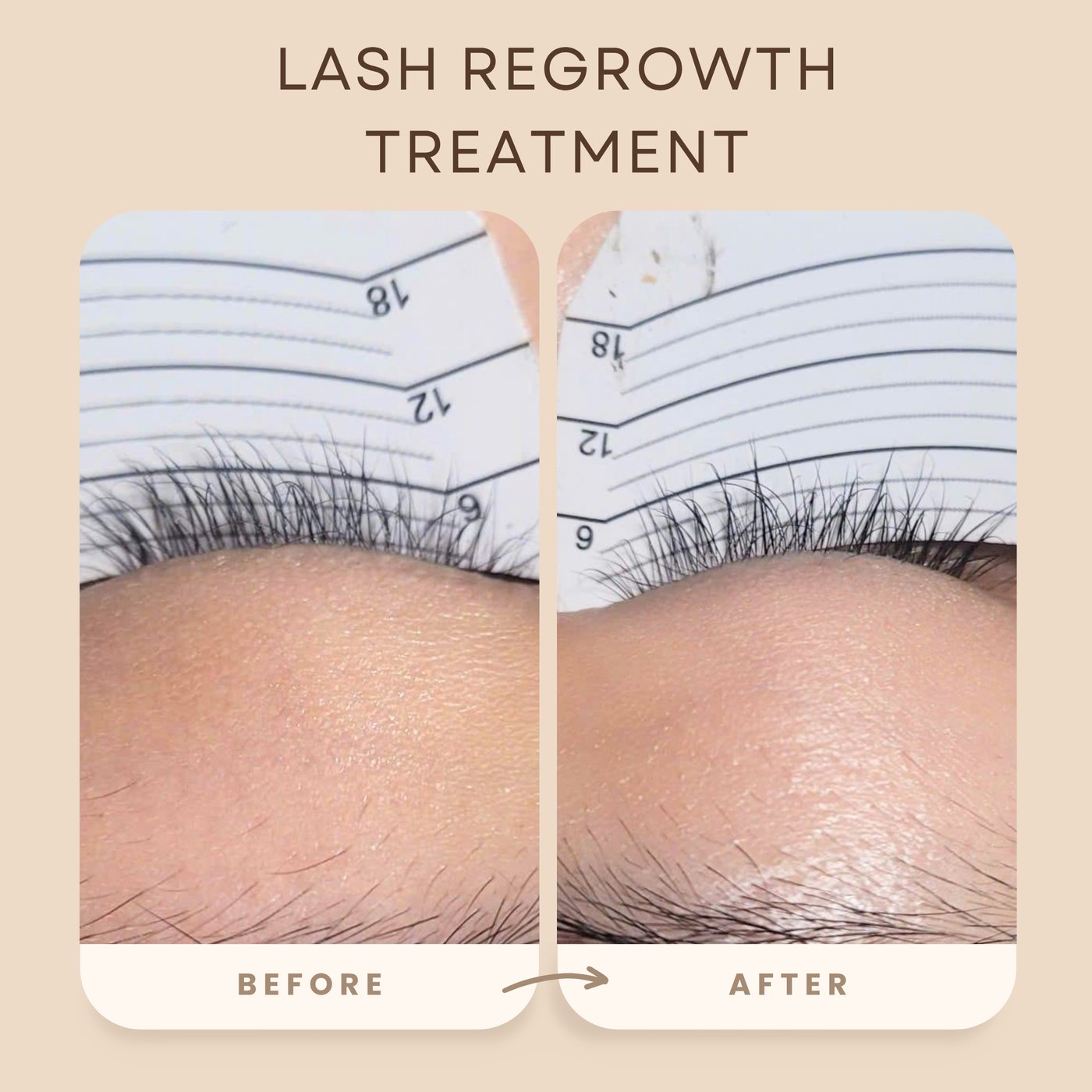 Lash regrowth treatment before and after at Lashdou